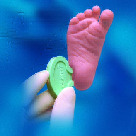 Lancet QuikHeel Infant Pediatric Lancet BD Microtainer™ Incision Device Blade 1.0 mm X 2.5 mmDepth 2.5 mm Blade Push Button Activated (50/BX 4BX/CS) by BD  ID 368101